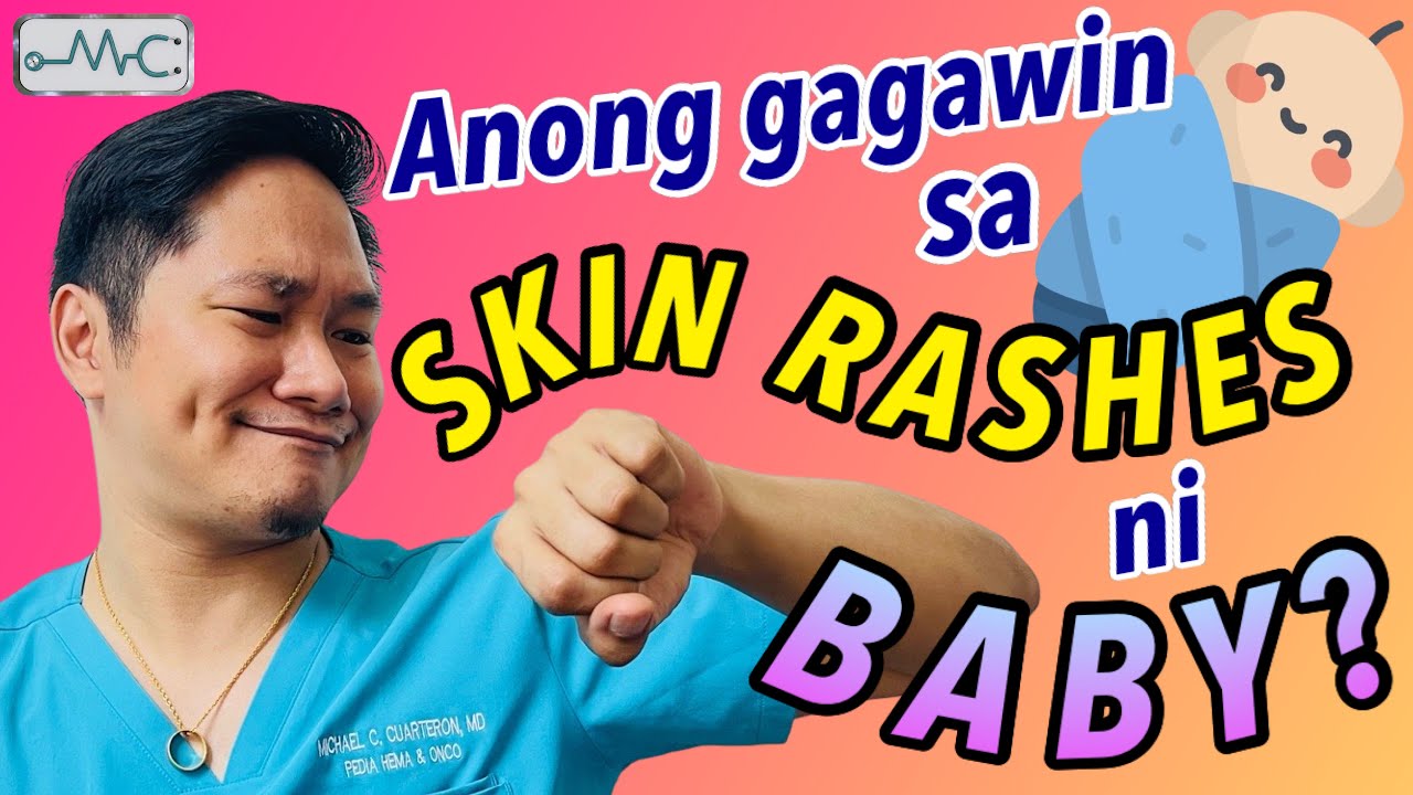 NEWBORN SKIN RASHES | SKIN RASHES NI BABY | Pedia Doc Mike