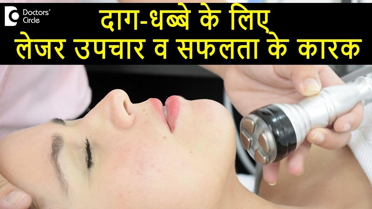 दाग-धब्बे के लिए लेजर उपचार व सफलता के कारक - डॉ. रसया दीक्षित