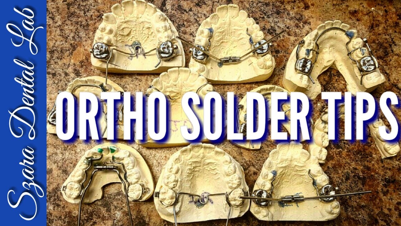 How to Solder Ortho appliances