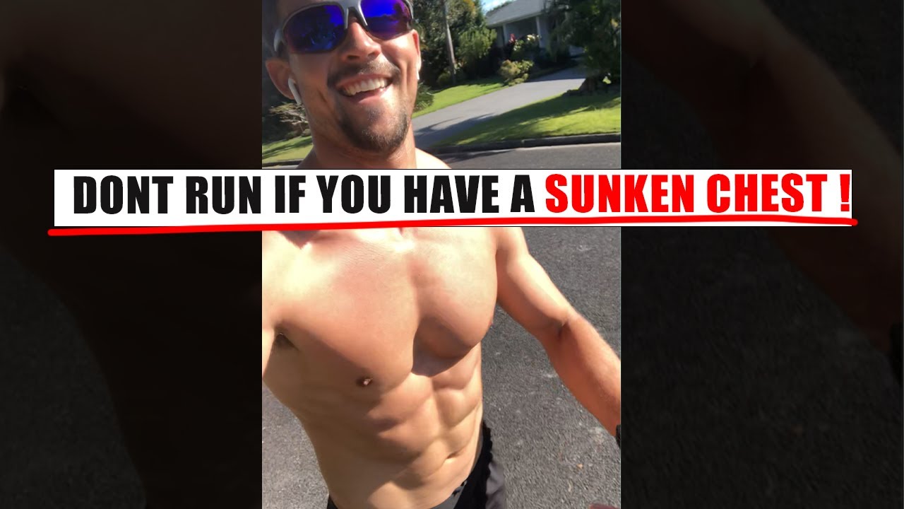 You Should NOT RUN if you have Pectus Excavatum (HERES WHY!)
