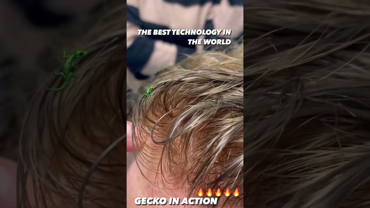 Alopecia areata: La tecnologia brevettata 3T Ionix Capelli Intelligenti &egrave; semplicemente stupefacente