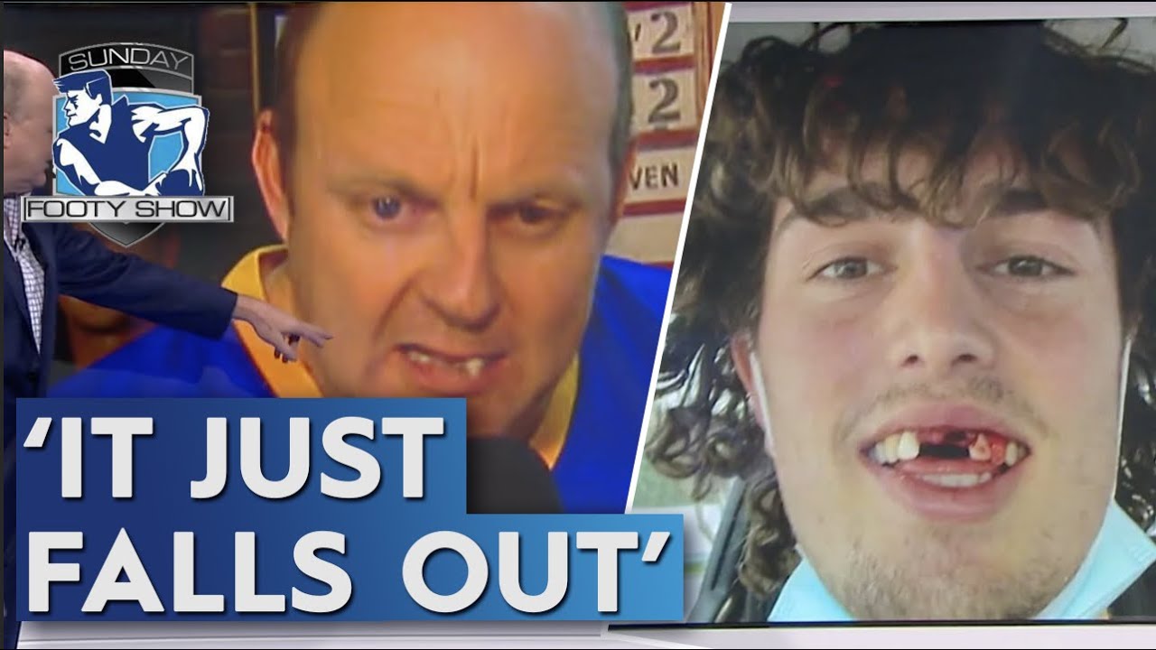 Five moments when AFL players have lost teeth mid-game - Sunday Footy Show | Footy on Nine
