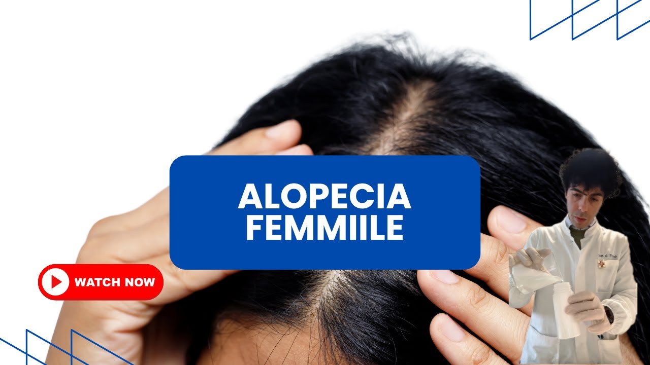 🔍 Alopecia Femminile e/o Ipotrichia Estrone Carenziale, Consigli,  Sintomi e Trattamenti Efficaci