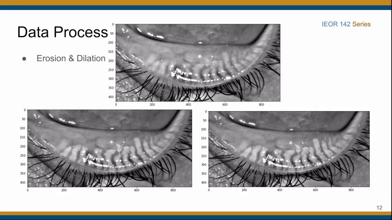 IEOR 142 Final Project