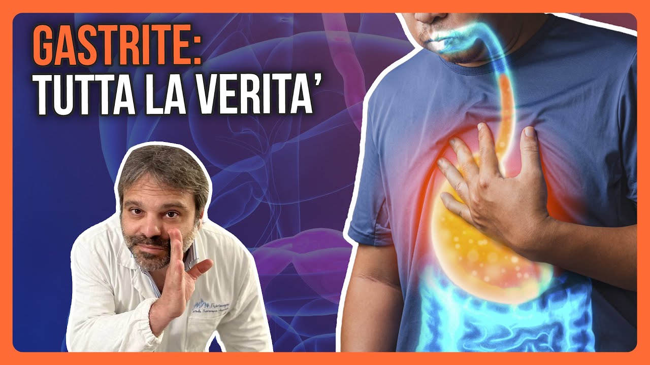 GASTRITE: Tutta la VERITÀ che ti NASCONDONO!😡