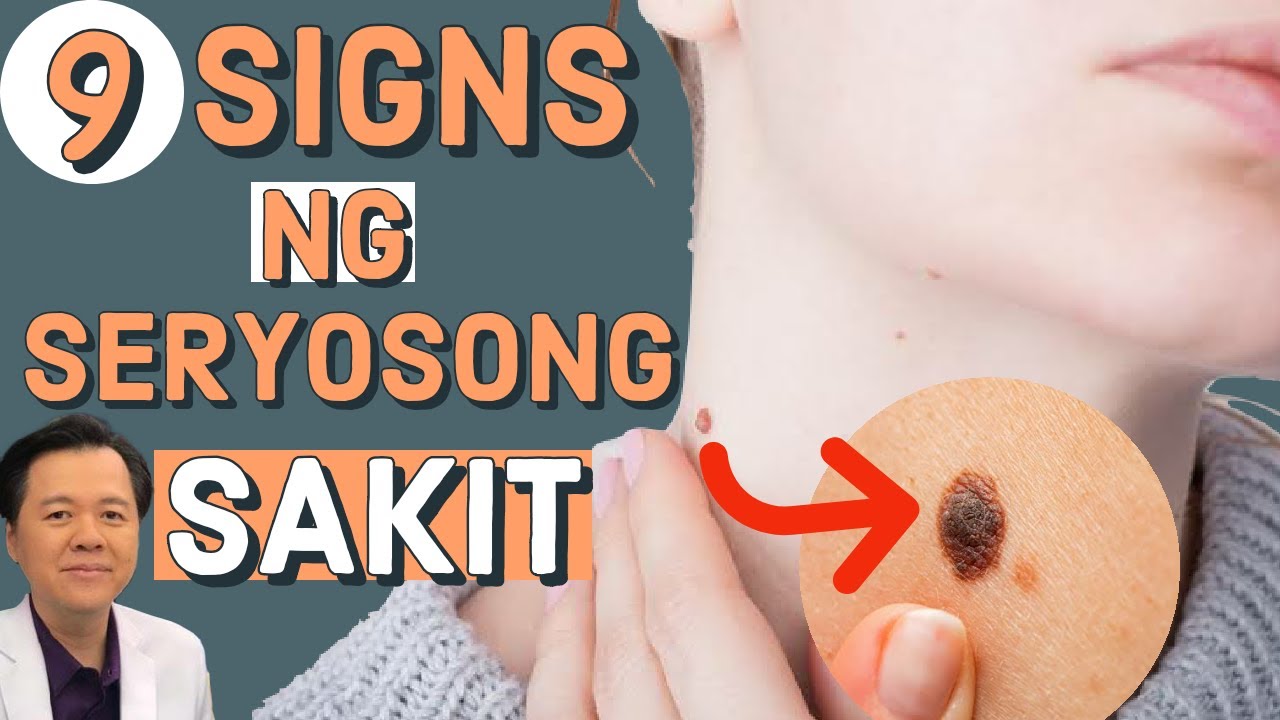 Babala: 9 Signs ng Seryosong Sakit - Payo ni Doc Willie Ong #1185