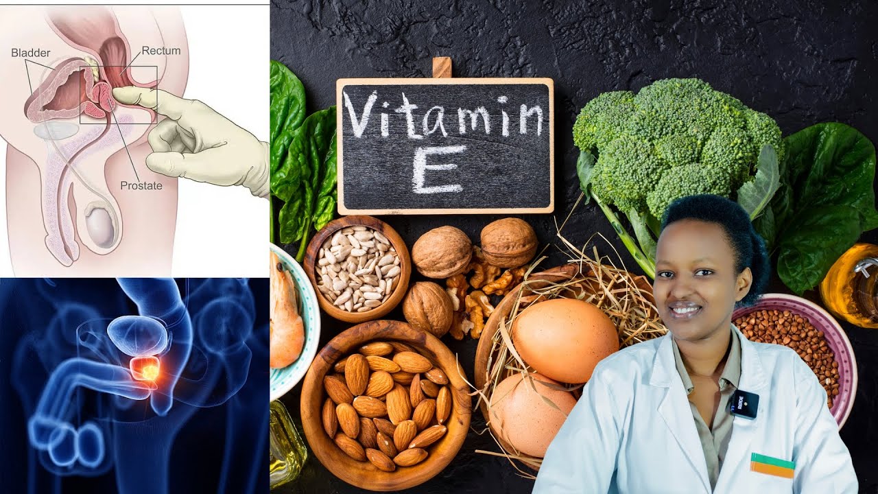 ⚠️‼️NIBA URI UMUGABO IBI BIRAKUREBA! PROSTATE: IBINTU 9 WAKWITAHO IKABA NZIMA !