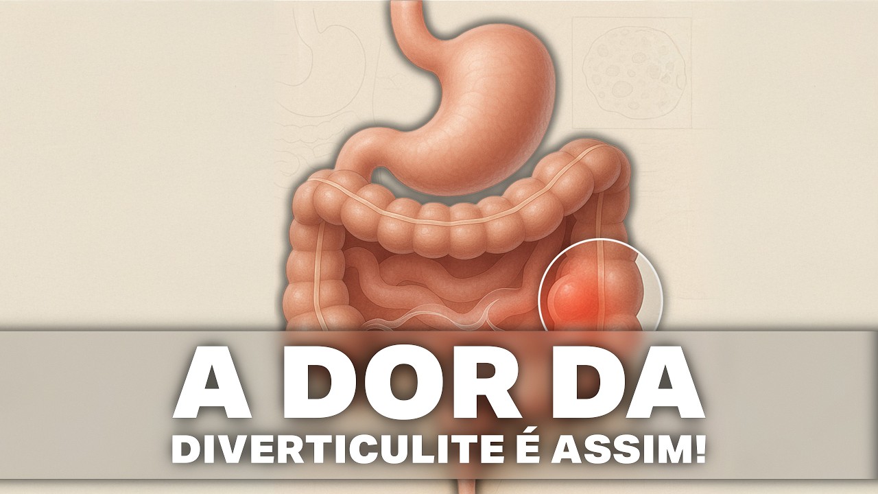 Como é a dor da diverticulite e quando procurar ajuda médica?