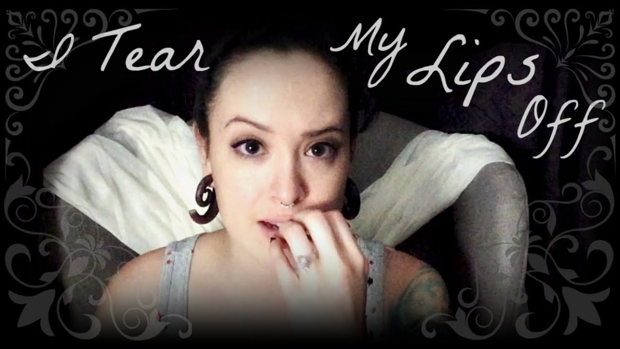 My Dermatillomania | BFRB Awareness | #thisisme