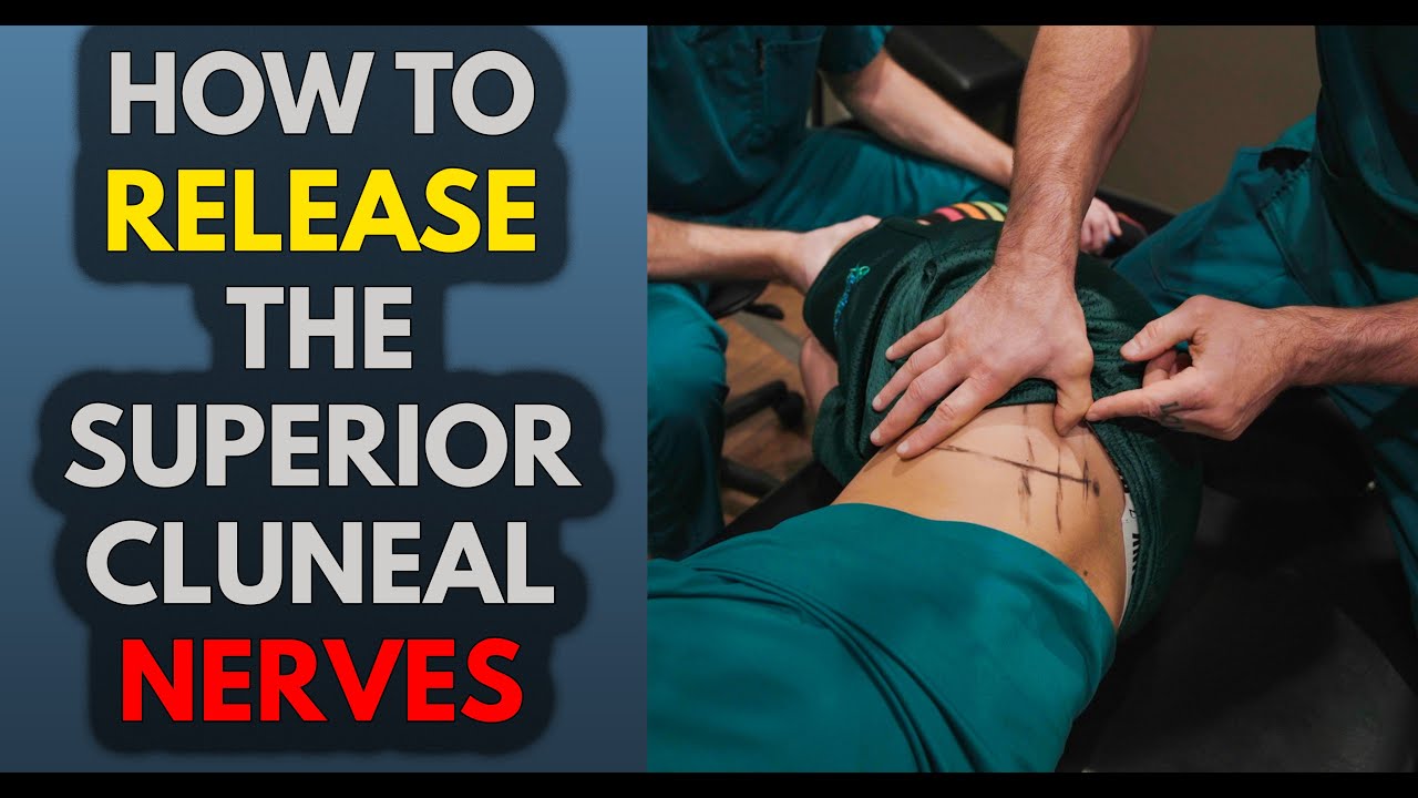 How To Release Superior Cluneal Nerve Entrapments with Adhesion Release Methods