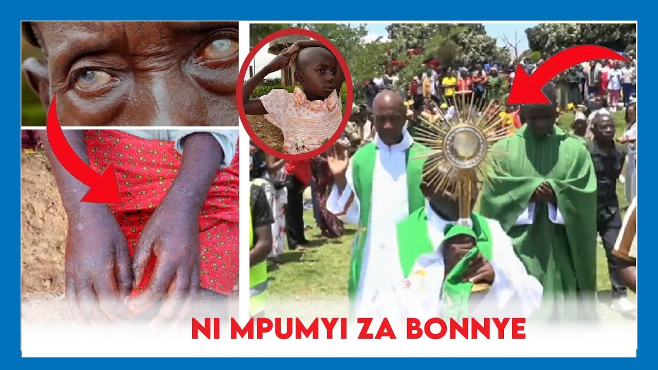 ABARWAYE INDWARA NYINSHI BAKIRIYE KU IBANGA RY'AMAHORO