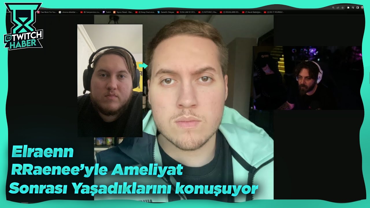 Elraenn, RRaenee'yle Kilo verme Ameliyatı Sonrası Yaşadıklarını Konuşuyor!