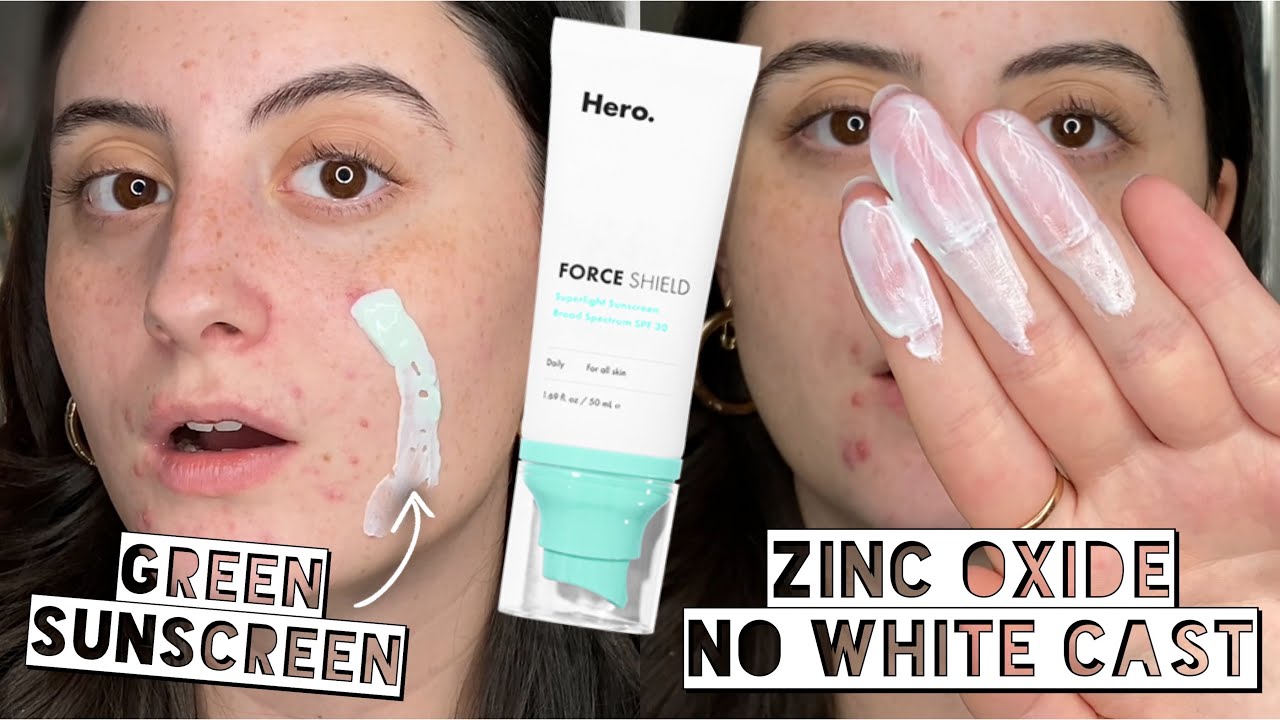 Hero Force Shield | TRYING AN ACNE GREEN TINTED ZINC OXIDE SUPERLIGHT SPF FOR 2 WEEKS
