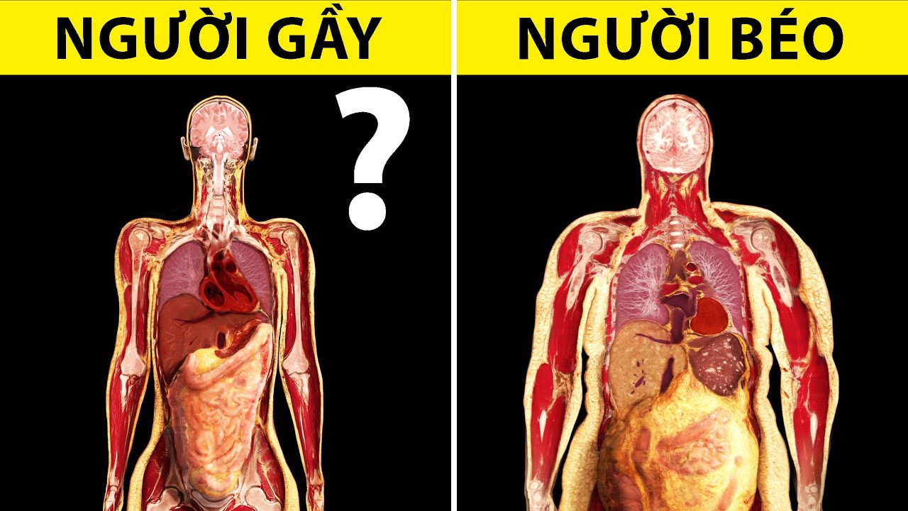 Vì Sao Người Gầy Lại... GẦY?!