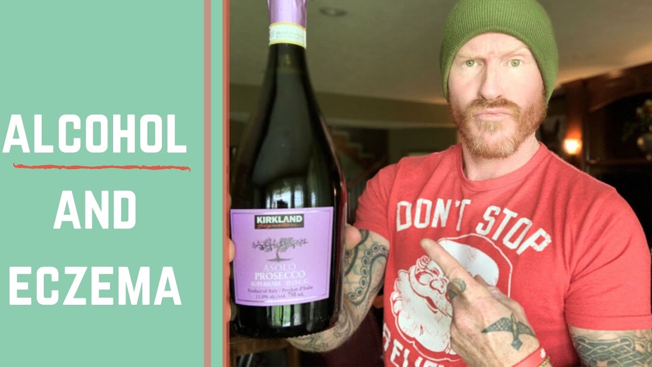 can you DRINK ALCOHOL AND HEAL ECZEMA / Do I DRINK