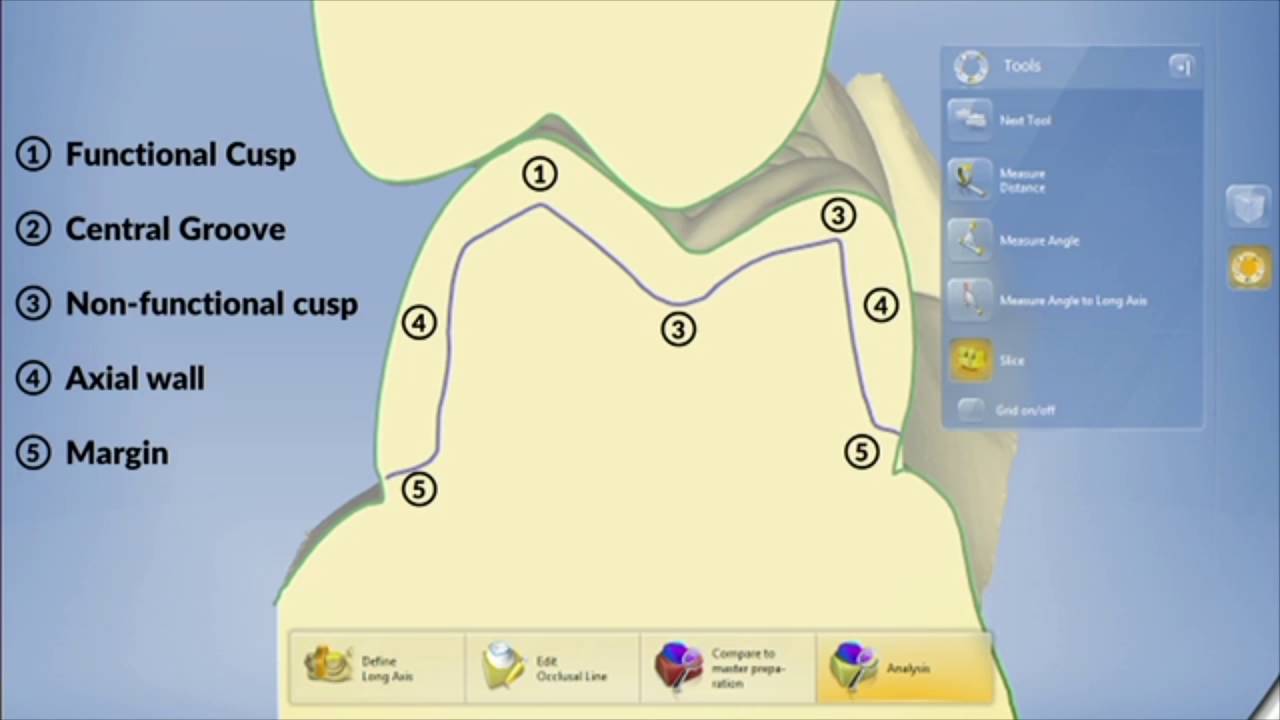 Crown Preparation Principles