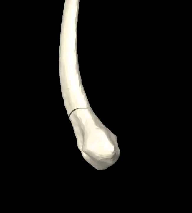 The surgical technique for correction of angular limb deformity at Fitzpatrick Referrals