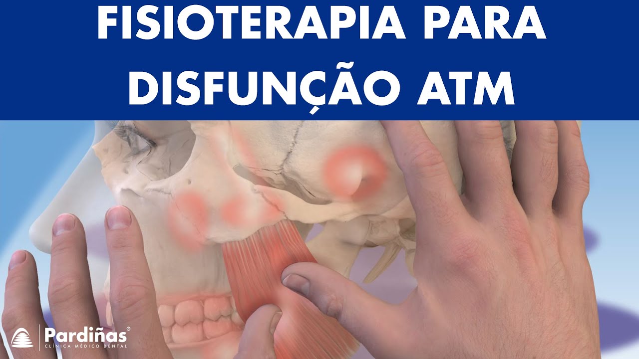 Como tratar a disfunção temporomandibular e dor orofacial com fisioterapia ©