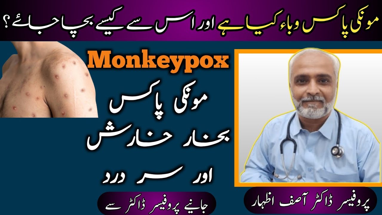 Monkeypox Kya Hai Aur Kaise Phelta Hai | Monkeypox Virus Causes & Prevention | Monkeypox Treatment