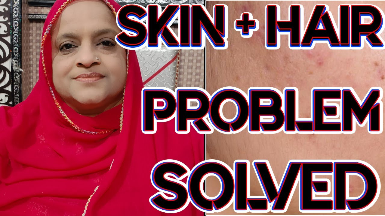Skin Problem Solved | Hair Problem Solved | YS Family N