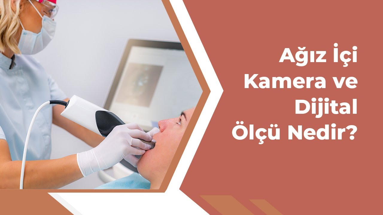 Ağız İçi Kamera ve Dijital Ölçü Nedir?