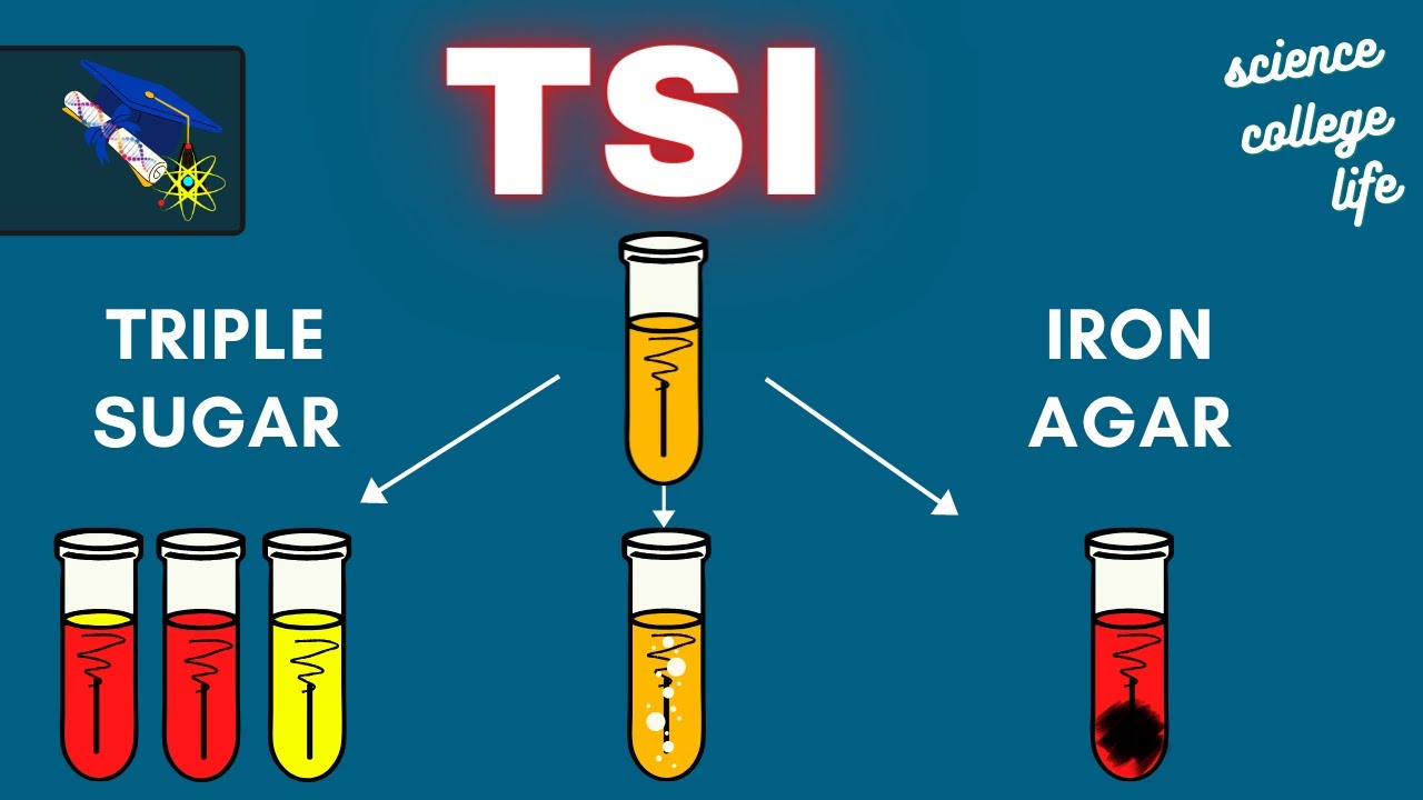 TSI | Triple Sugar Iron Agar Test | Microbiology Lab