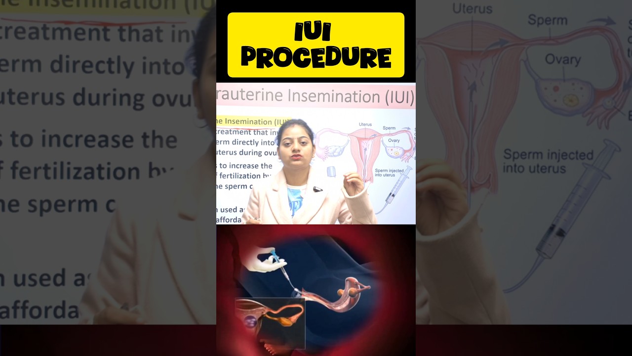 iui procedure 
