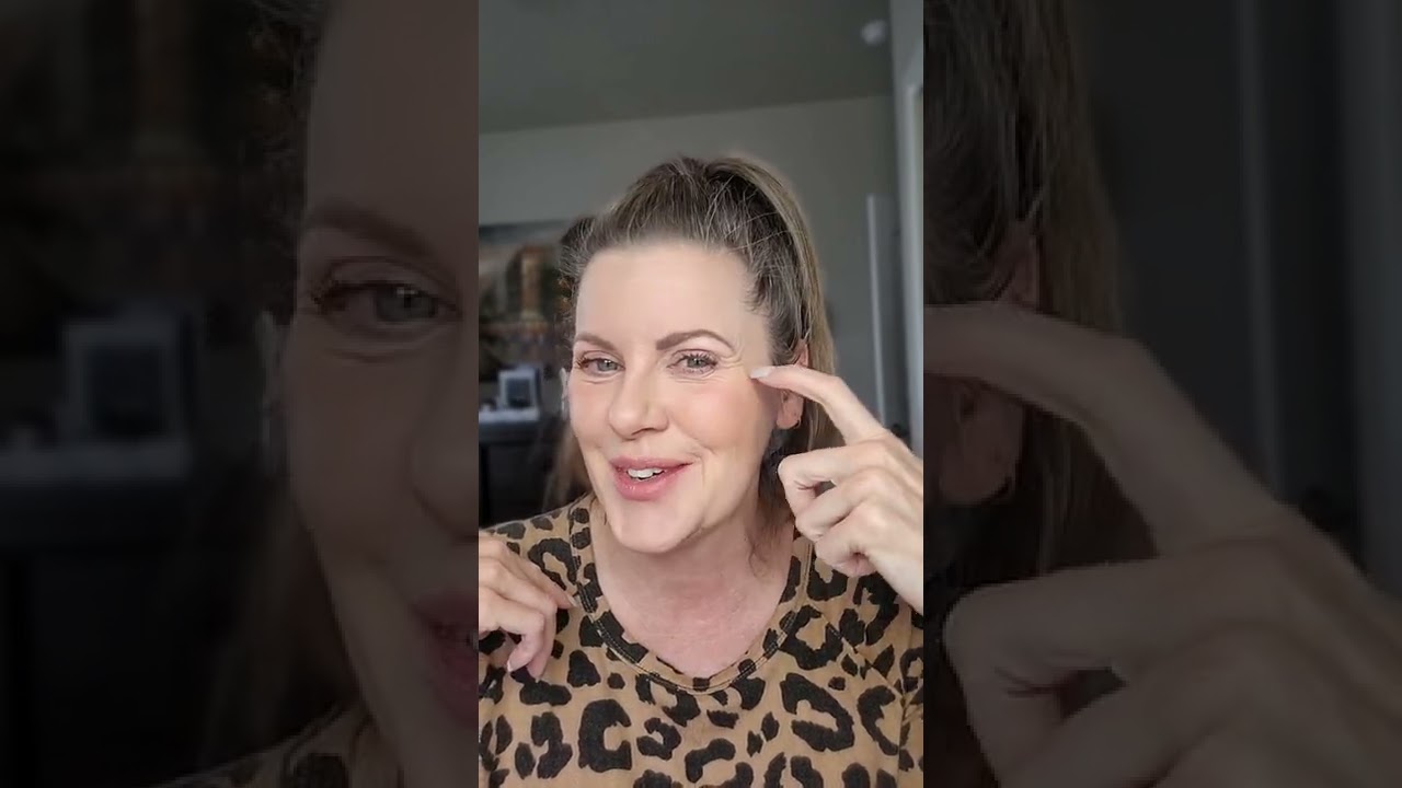 Blepharoplasty: before-3 months past surgery