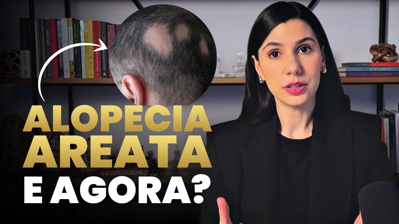 O QUE É ALOPECIA AREATA E COMO TRATAR