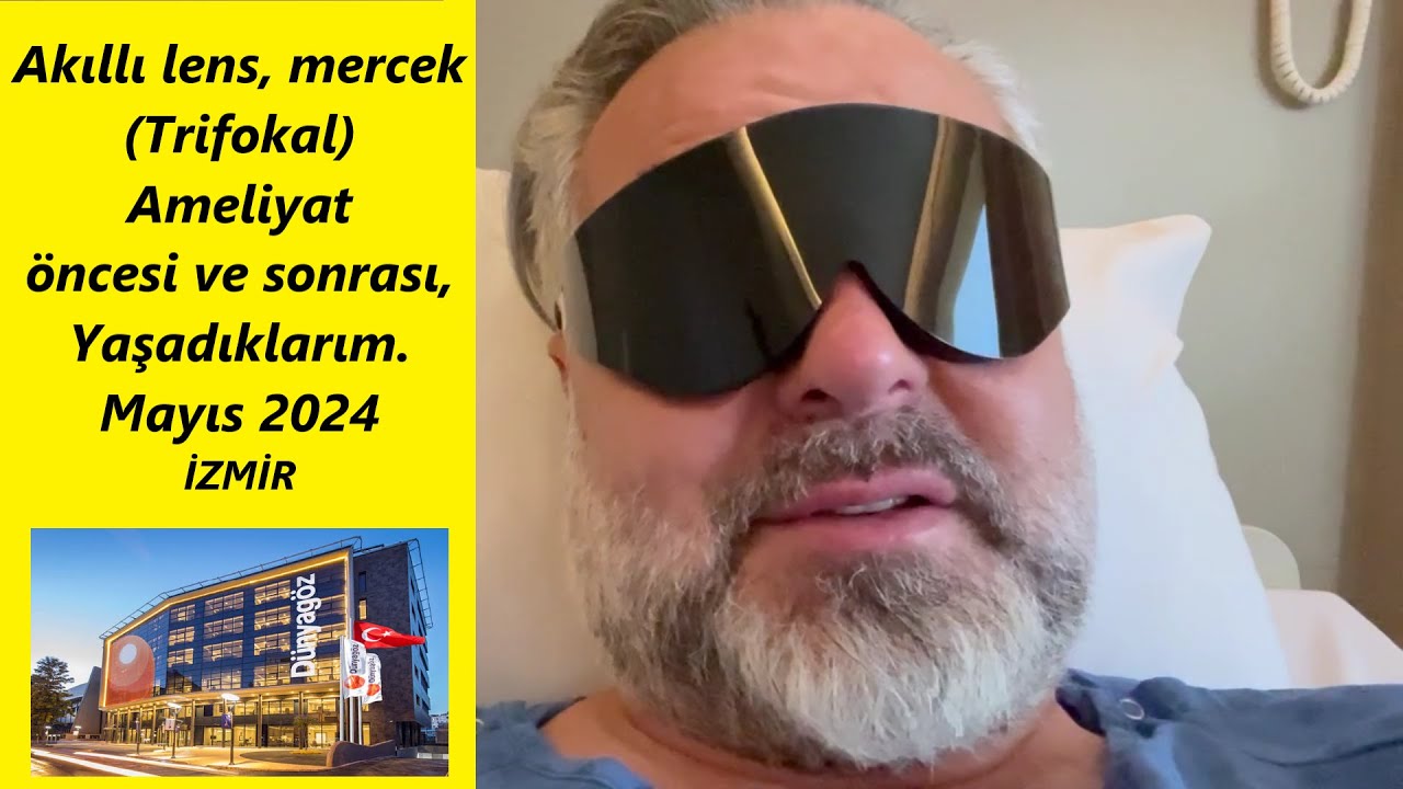 Alcon Akıllı Lens Ameliyatı ile Gözlüklerden Kurtulduk! Dünya Göz Hastanesi Deneyimim 👀