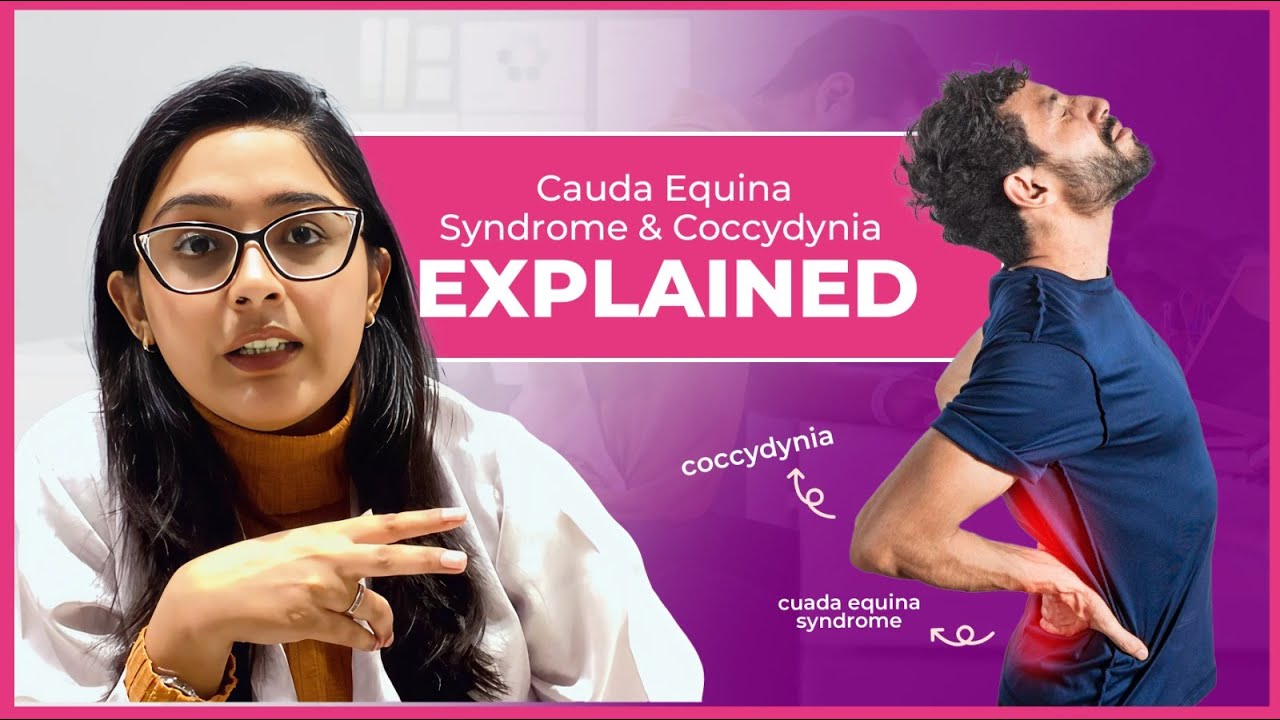 Cauda Equina vs Coccydynia | Don’t Confuse These Two Conditions