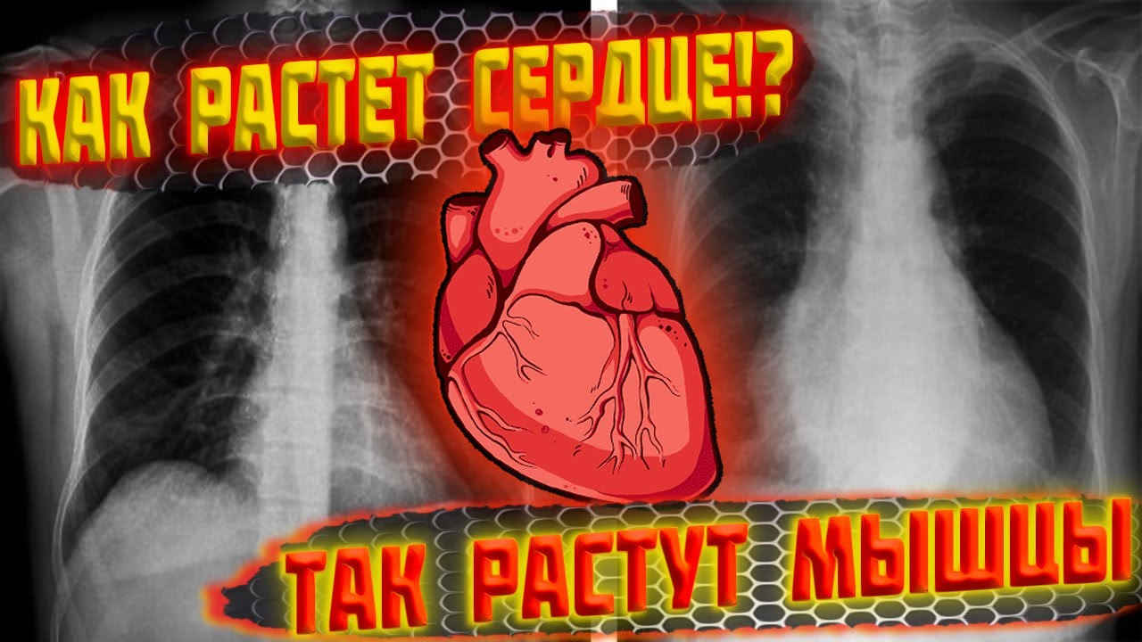 Как растет сердце!? Так растут мышцы...