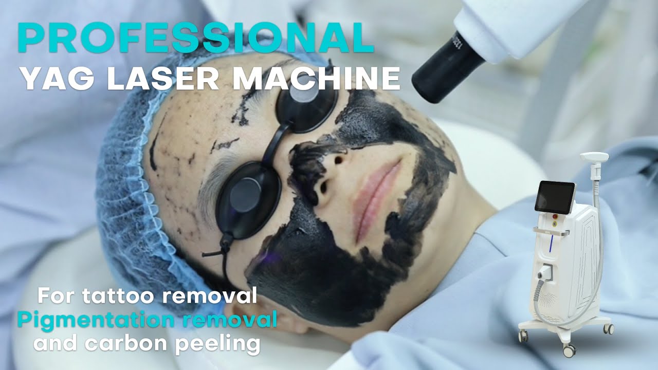 Professional YAG Laser Machine for Tattoo Removal, Pigmentation, and Carbon Peeling