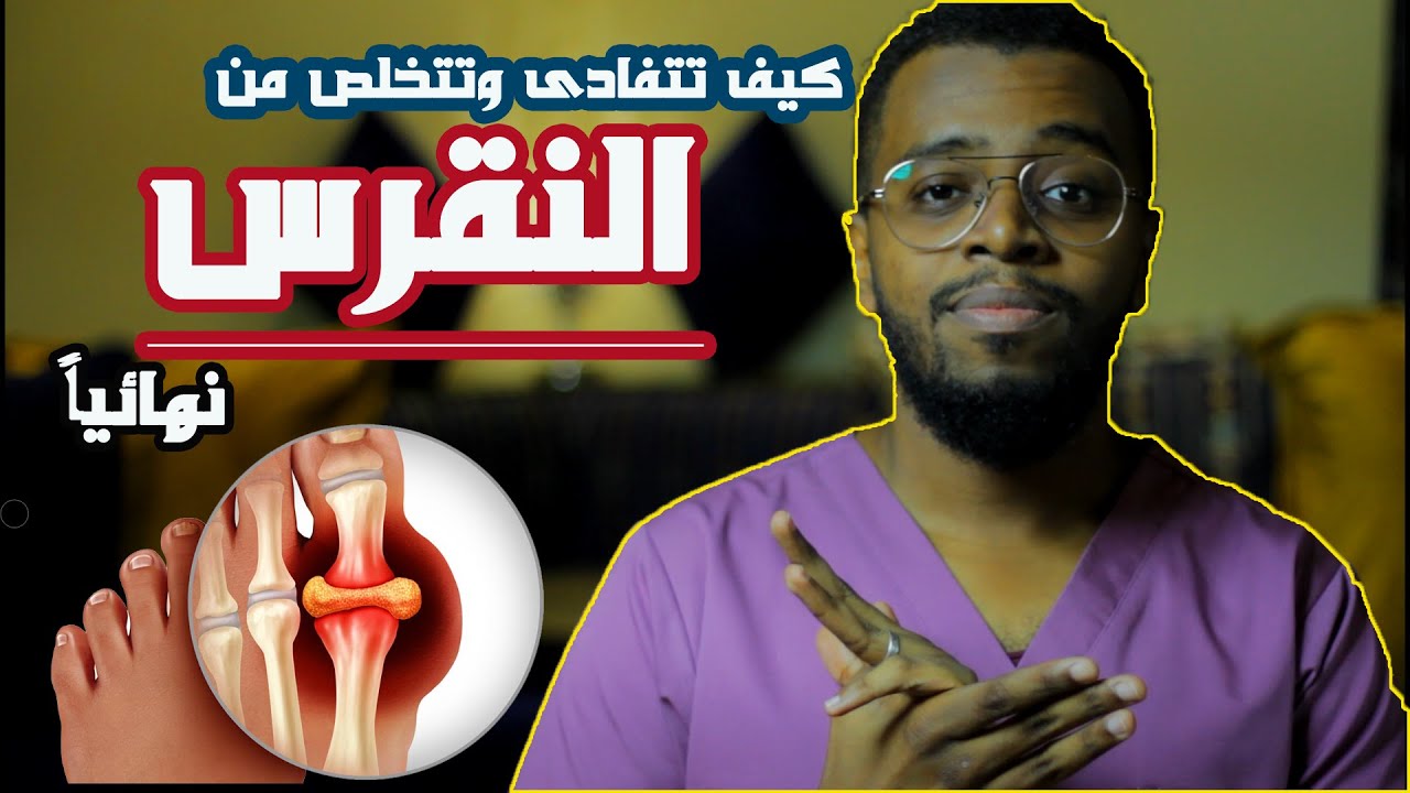 كيف تتخلص من جذور النقرس بدون أدوية .. SOLUTIONS FOR GOUT