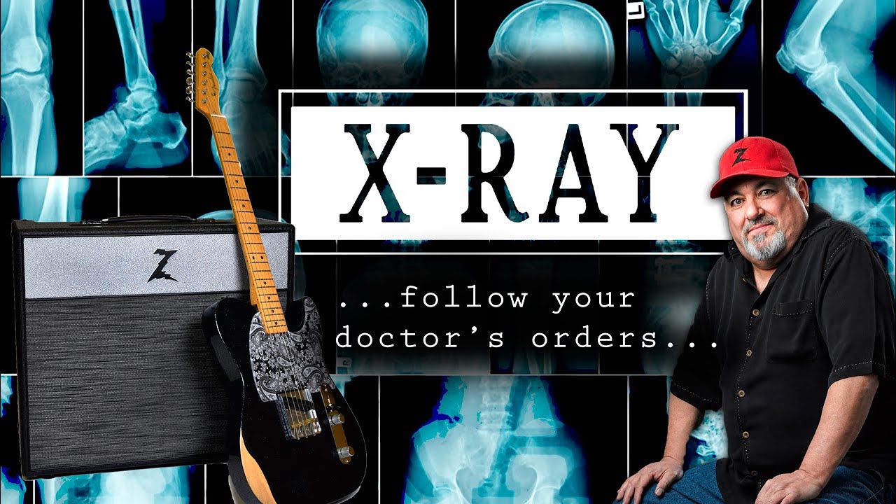 Bones of the Stang Ray, Heart of the DB4? The NEW X-RAY!