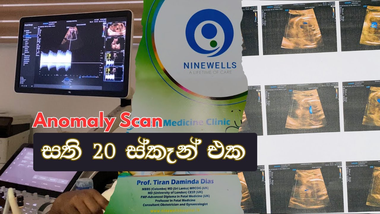 බබාගේ හැමදේම බලාගත්ත දවස | Full Anomaly Scan Video in Sri Lanka