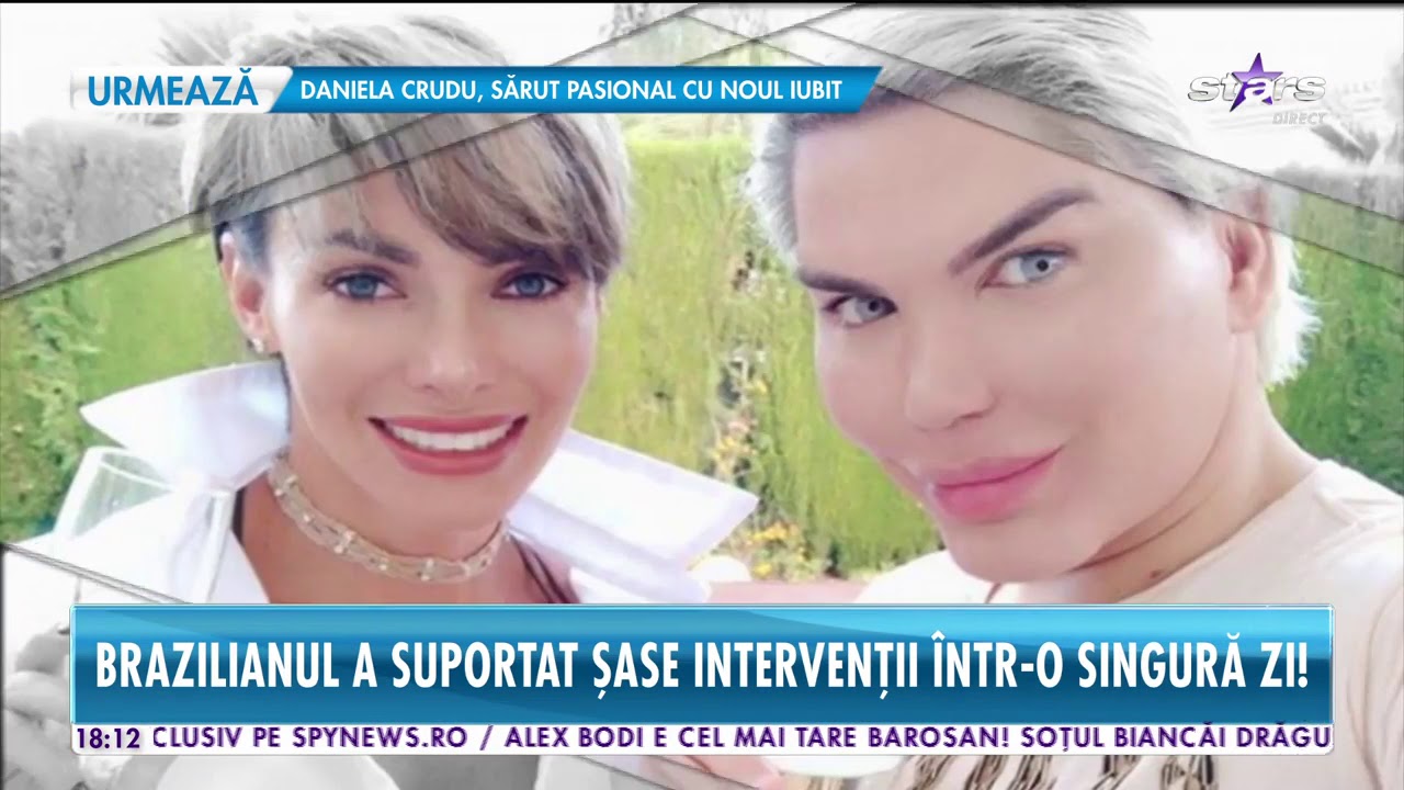 Păpușa Ken a devenit Barbie! Brazilianul a făcut 62 de operații estetice p&acirc;nă la 36 de ani