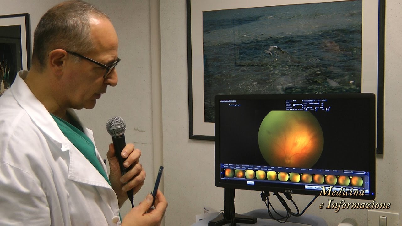 ROP: Retinopatie Pediatriche nei bambini nati prematuri