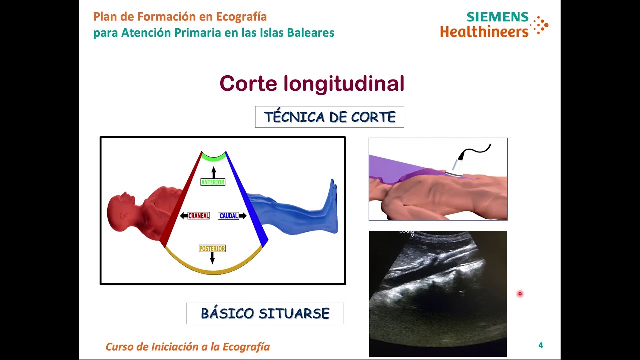 ECOGRAFÍA CLINICA ABDOMINAL I INICIACIÓN  Dr.Josep Corcoll Reixach. Aula Eco-APIB.