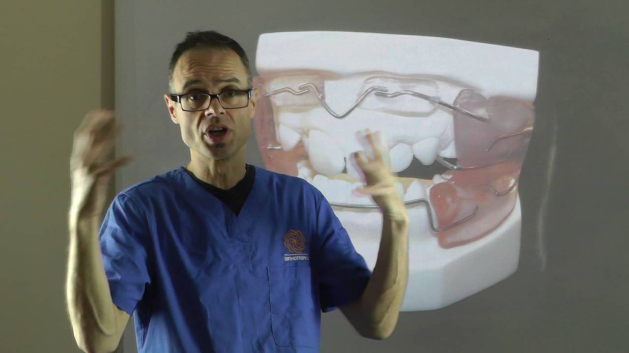 Effect of Frankel Regulator on Teeth Alignment & Bone During Orthodontic Treatment by Dr Mike Mew