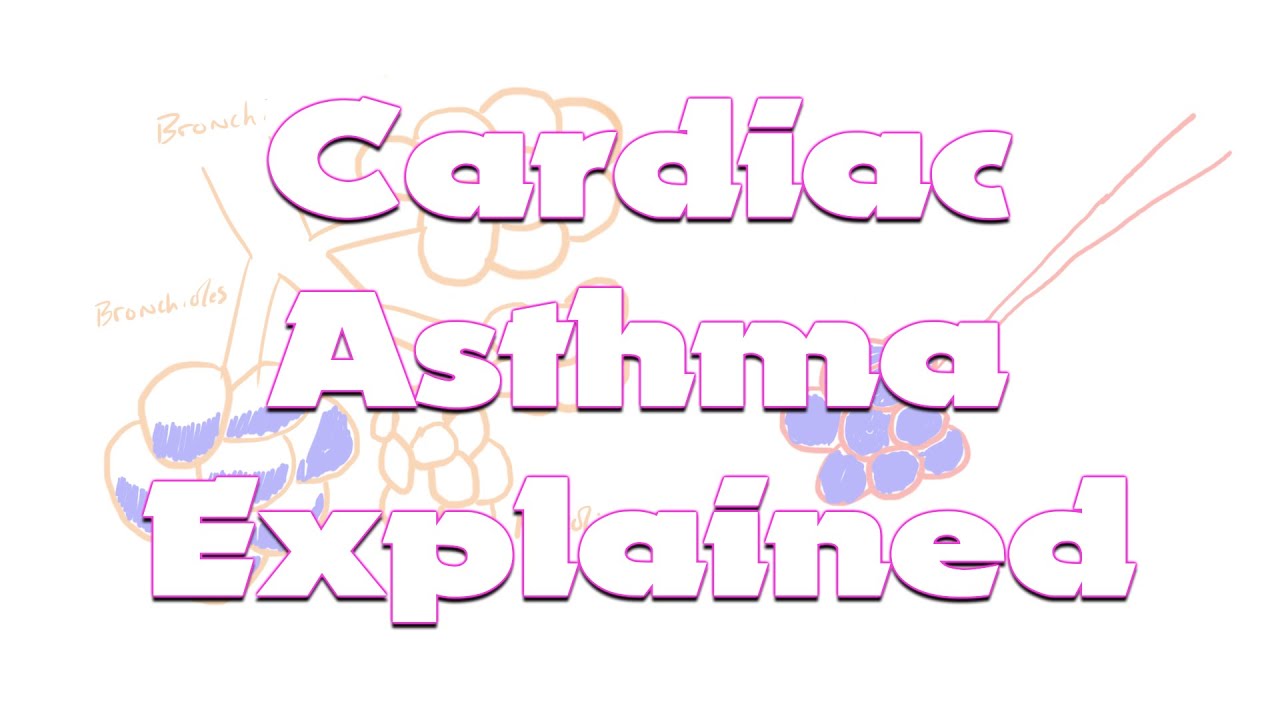 Cardiac Asthma Vs Pulmonary Edema | Something In About 5 Minutes | Medic Materials