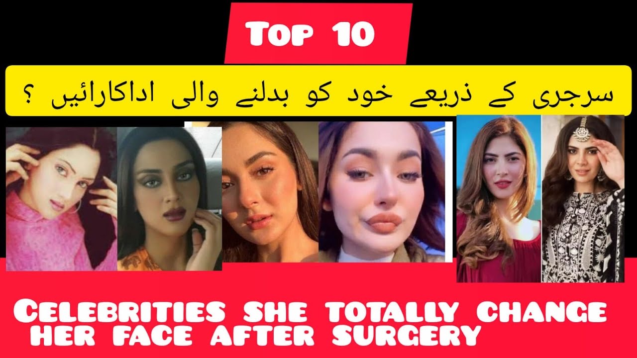 Beautiful actresses Before And After Surgery || Pakistani Darama Industry  || Drama Actresses
