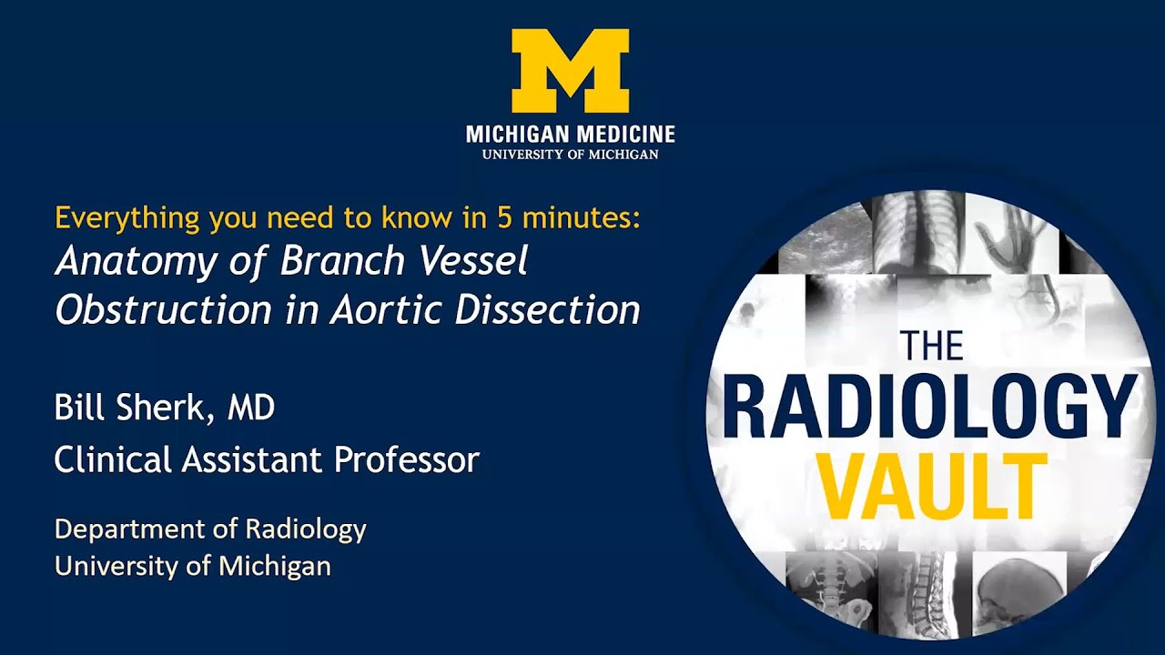 CT Findings of Aortic Dissection Branch Vessel Obstruction