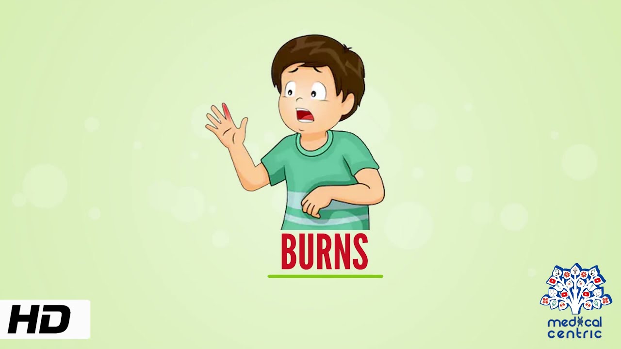 Burns, Causes, Signs and Symptoms, Diagnosis and Treatment.