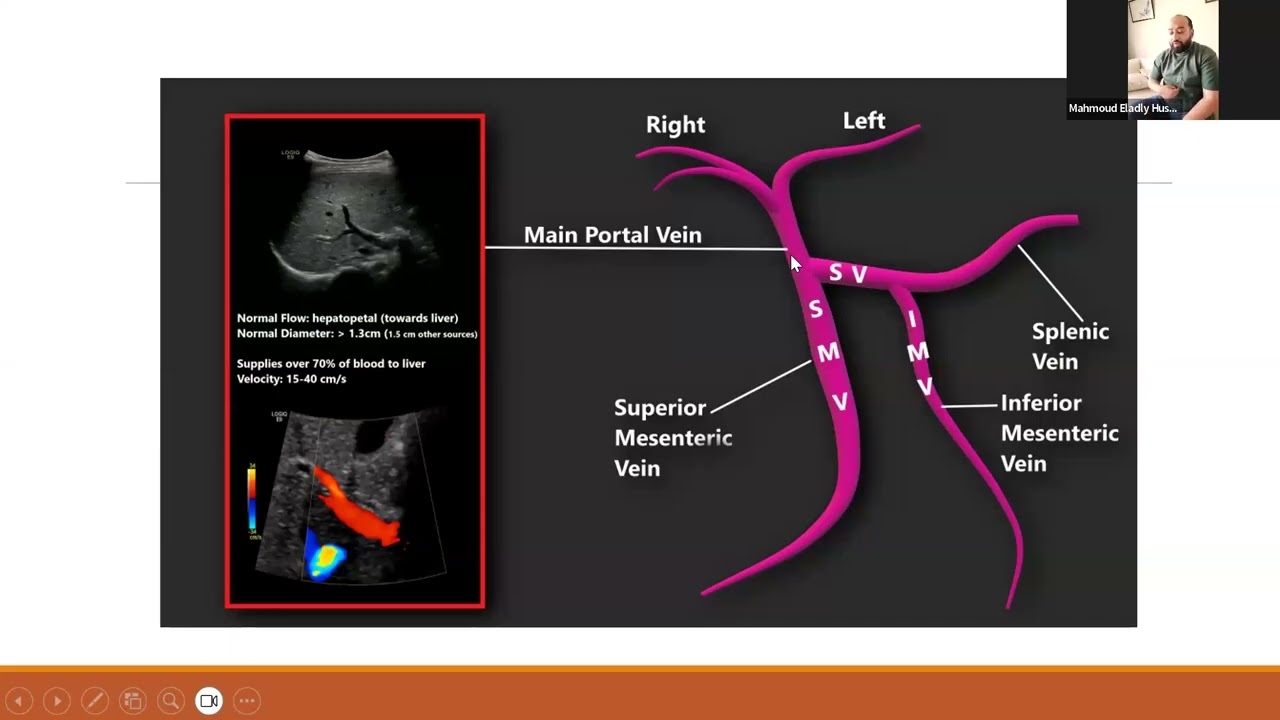 Pediatric ultrasound: Portal vein, pancreas, spleen, urinary tract, Ascites and FAST exam, bowel. 