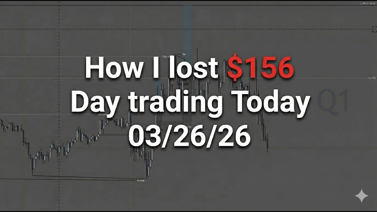 How I lost $156 DayTrading Today & Hella Psych Issues