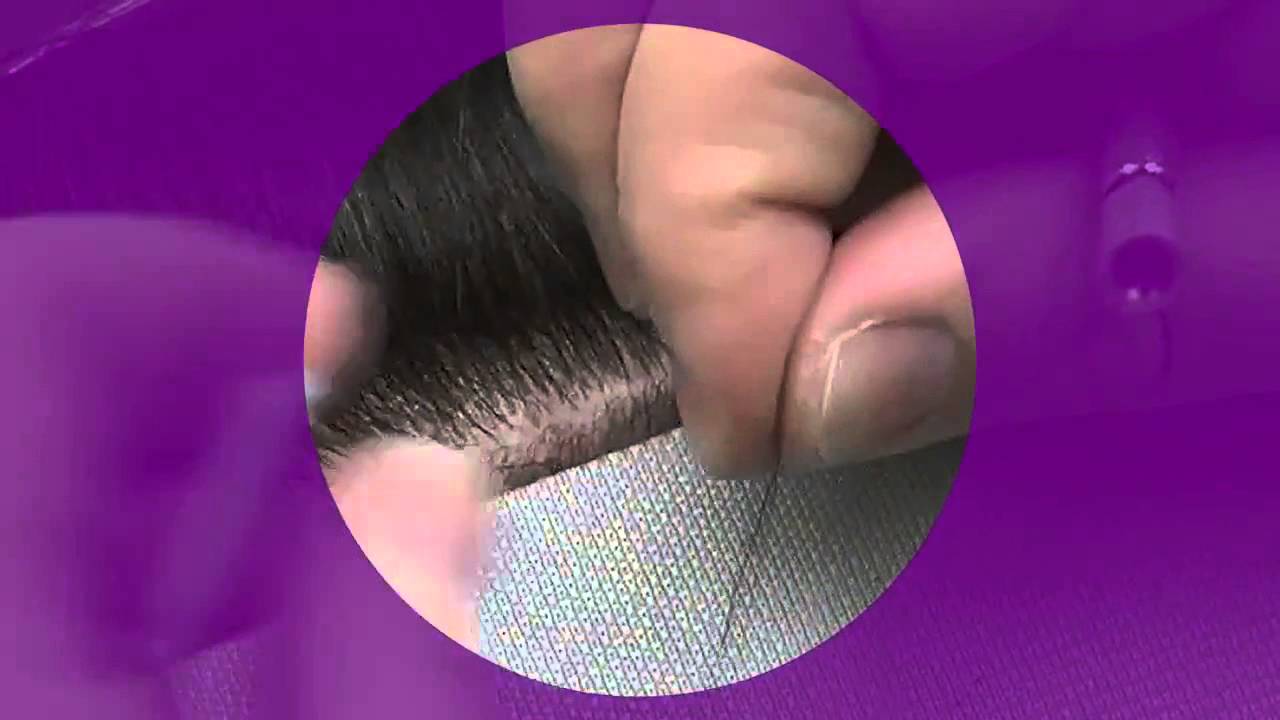 The Micro Point Link Solution