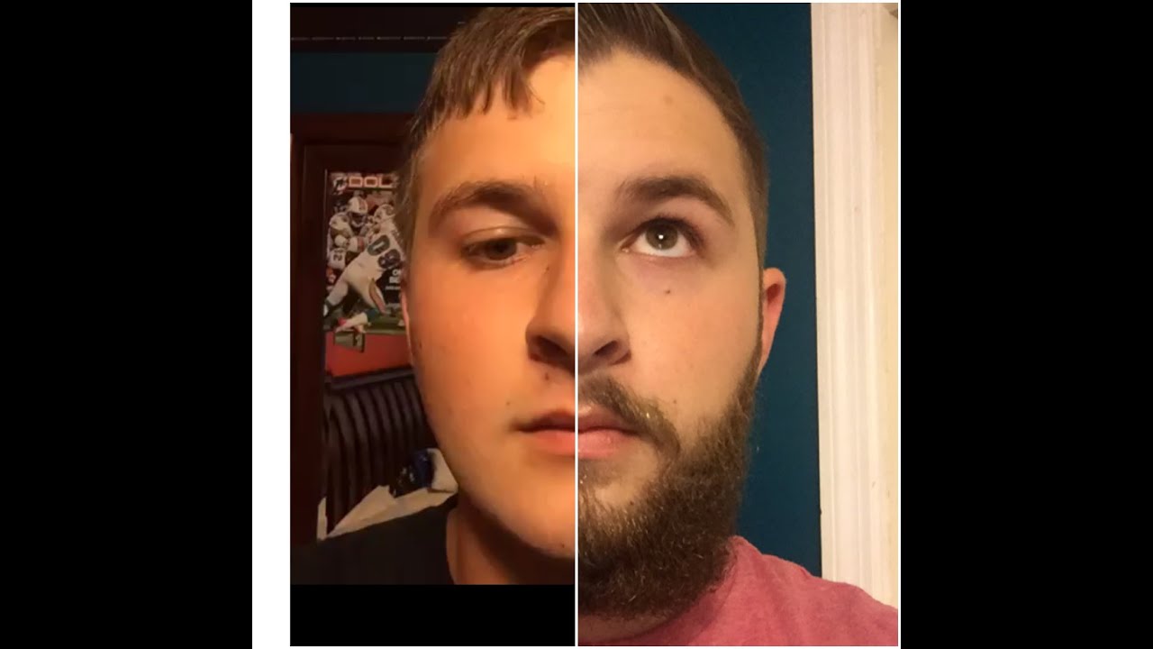 17 year old beard journey (timelapse update)