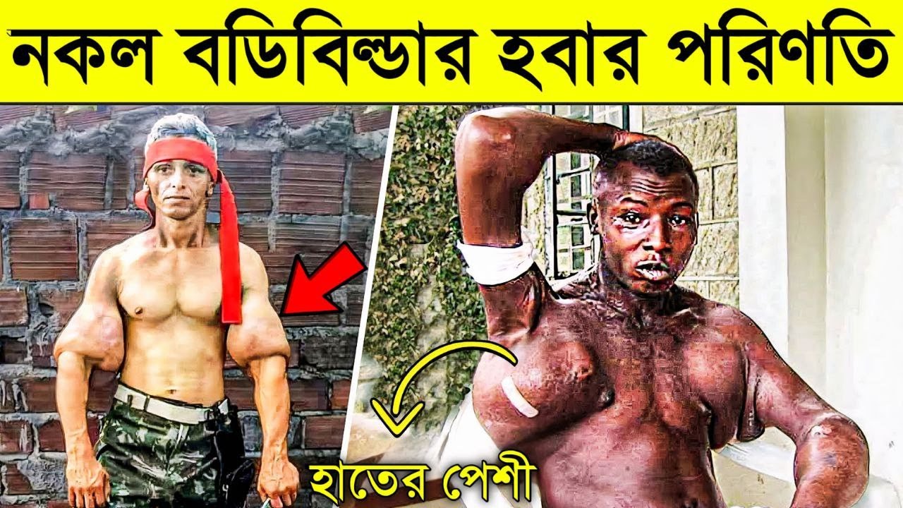 বডিবিল্ডিং এর ভয়াবহ আসক্তির পরিনতি কি হয় দেখুন | Dark Side of Bodybuilding | Fake Bodybuilder