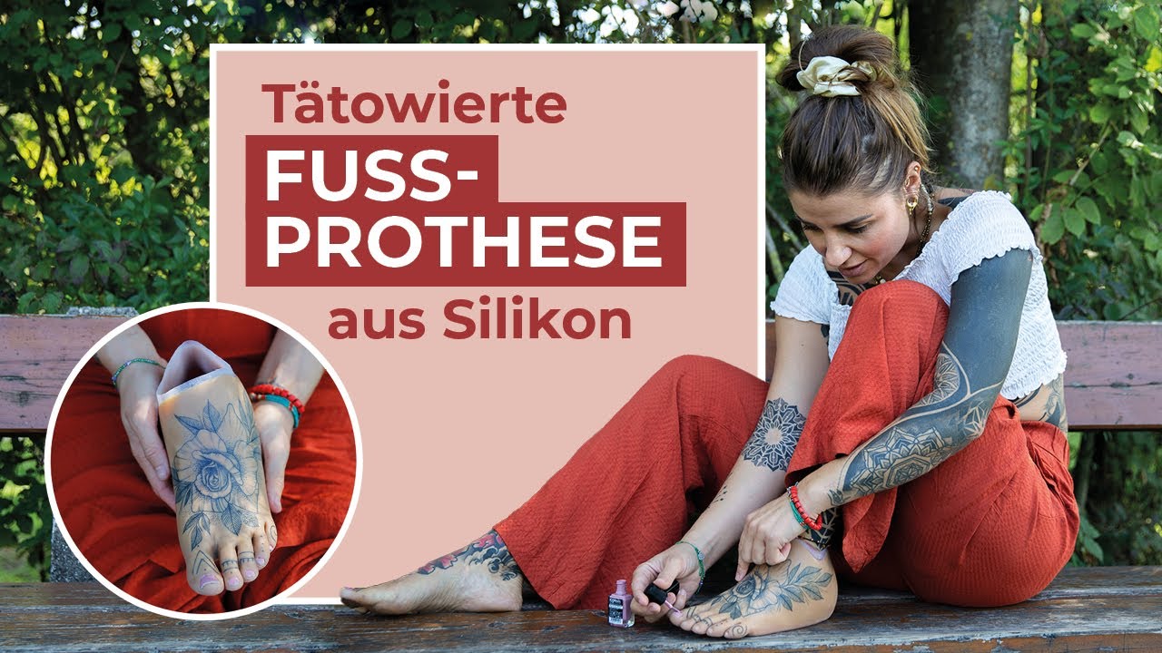 Fußprothese mit Tattoos schenkt Nicole mehr Lebensqualität